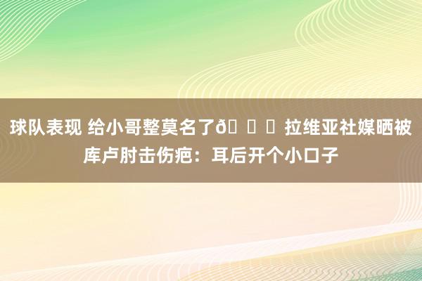 球队表现 给小哥整莫名了😅拉维亚社媒晒被库卢肘击伤疤：耳后开个小口子